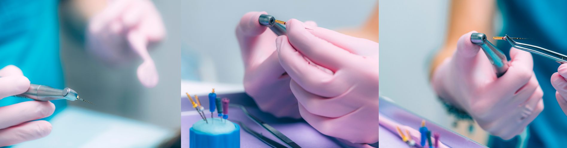 Common Endodontic Procedures