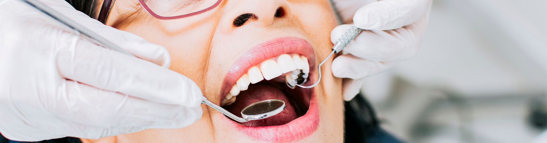 Fractured Tooth Treatment